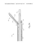 FEATURES TO APPLY FLUID TO AN ULTRASONIC BLADE OF A SURGICAL INSTRUMENT diagram and image