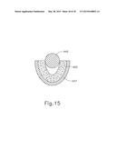 FEATURES TO APPLY FLUID TO AN ULTRASONIC BLADE OF A SURGICAL INSTRUMENT diagram and image