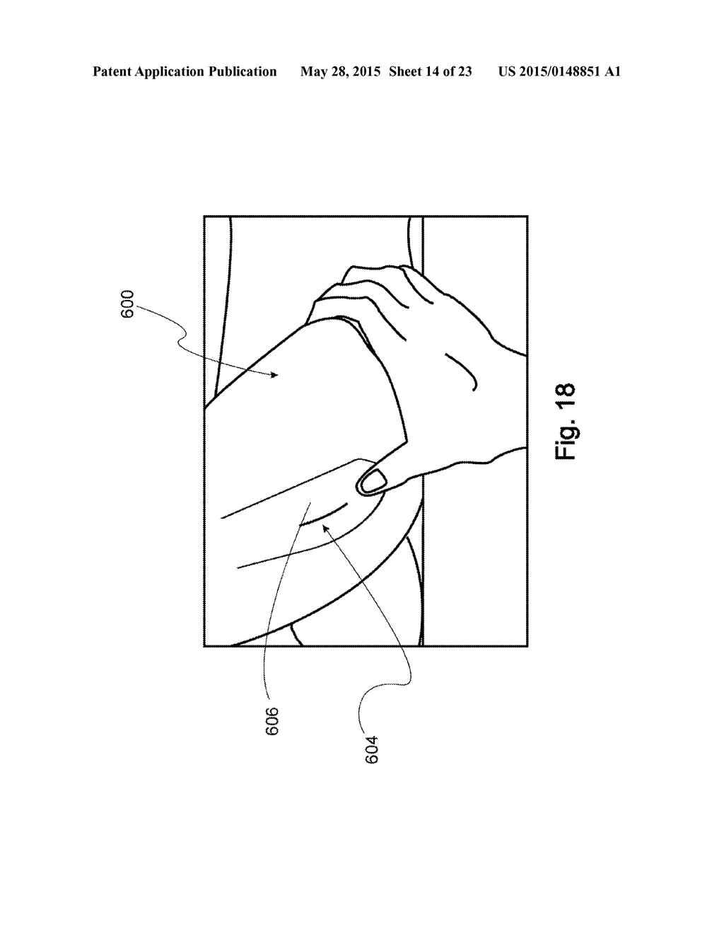 Devices, Systems, and Methods for Acetabulum Repair - diagram, schematic, and image 15