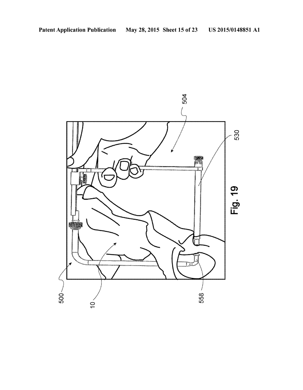 Devices, Systems, and Methods for Acetabulum Repair - diagram, schematic, and image 16