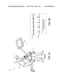 RESCUER PROTECTION FROM ELECTRICAL SHOCK DURING DEFIBRILLATION diagram and image