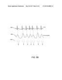 RESCUER PROTECTION FROM ELECTRICAL SHOCK DURING DEFIBRILLATION diagram and image