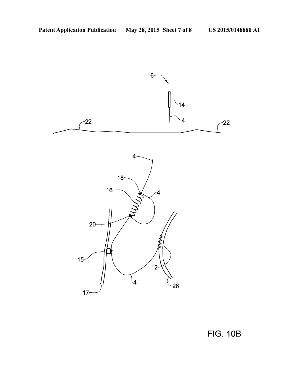 IMPLANTABLE MEDICAL DEVICE - diagram, schematic, and image 08