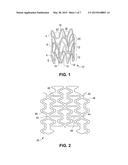 Stents With Radiopaque Markers diagram and image