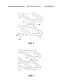 Stents With Radiopaque Markers diagram and image