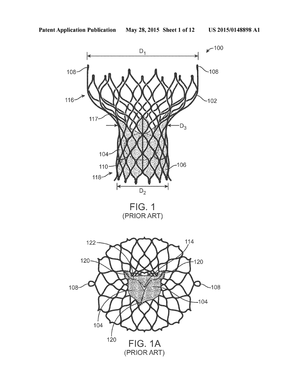 Anti-Paravalvular Leakage Component for a Transcatheter Valve Prosthesis - diagram, schematic, and image 02