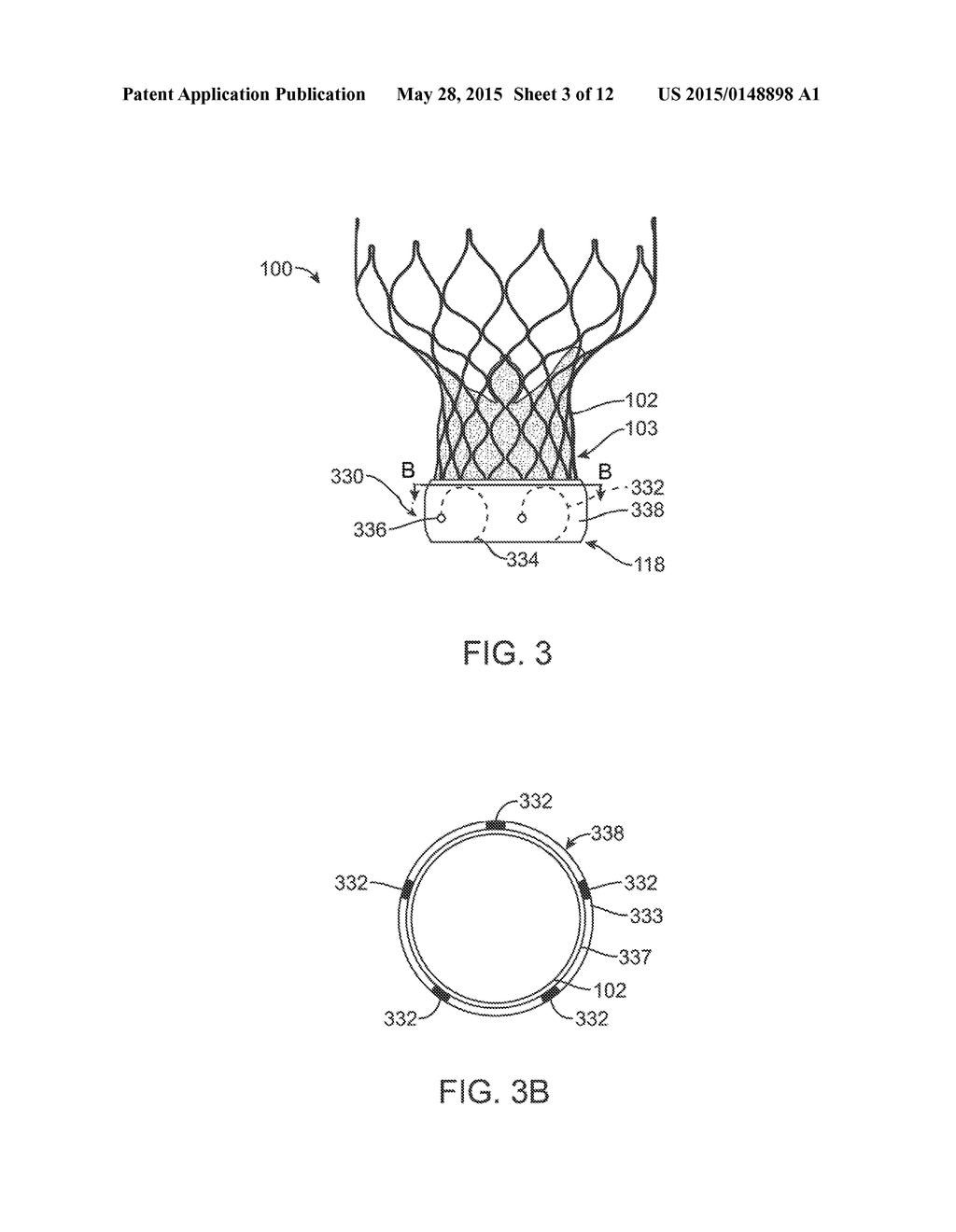 Anti-Paravalvular Leakage Component for a Transcatheter Valve Prosthesis - diagram, schematic, and image 04