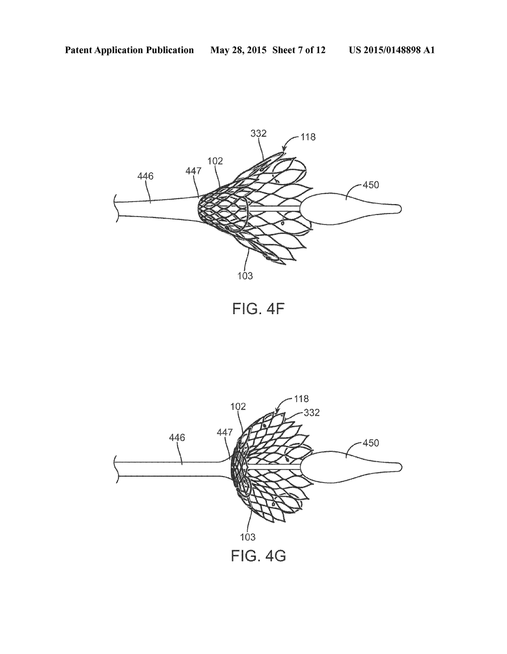 Anti-Paravalvular Leakage Component for a Transcatheter Valve Prosthesis - diagram, schematic, and image 08