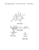 FUSION CAGE WITH COMBINED BIOLOGICAL DELIVERY SYSTEM diagram and image