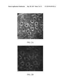 System and Method For Determining and Displaying the Metabolic Energy of     Skin Cells diagram and image