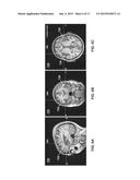 Drug-Enhanced Neurofeedback diagram and image