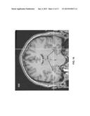 Drug-Enhanced Neurofeedback diagram and image