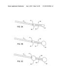 GASTRIC RETAINING DEVICES AND METHODS diagram and image