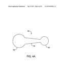 GASTRIC RETAINING DEVICES AND METHODS diagram and image