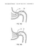 GASTRIC RETAINING DEVICES AND METHODS diagram and image