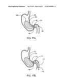 GASTRIC RETAINING DEVICES AND METHODS diagram and image