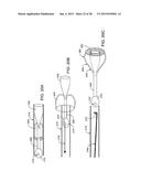 GASTRIC RETAINING DEVICES AND METHODS diagram and image