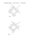 MEDICAL BALLOON diagram and image