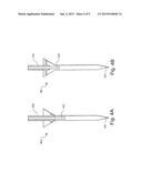 Pressure Wave Root Canal Cleaning System diagram and image