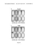 Surfactant Lipids, Compositions Thereof, and Uses Thereof diagram and image