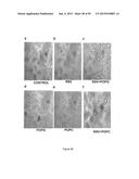 Surfactant Lipids, Compositions Thereof, and Uses Thereof diagram and image