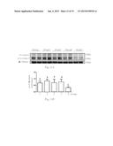 Method for treating or preventing heart diseases diagram and image