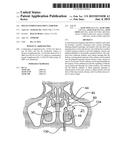 MULTI-CONDUIT BALLOON CATHETER diagram and image