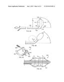 MULTI-CONDUIT BALLOON CATHETER diagram and image