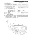 COLORIZED DAMPING INDICATORS FOR CUSTOMIZED GOLF CLUB HEADS diagram and image