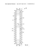 SUPPORT STRUCTURE FOR PLEATED FILTER MEDIA AND METHODS diagram and image