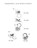 Apparatus, System and Method for Fluid Delivery diagram and image