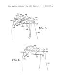 Knitted Band With Integrated Ventilation diagram and image