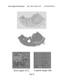 Method for Quantifying Immune Cells in Tumoral Tissues and its     Applications diagram and image