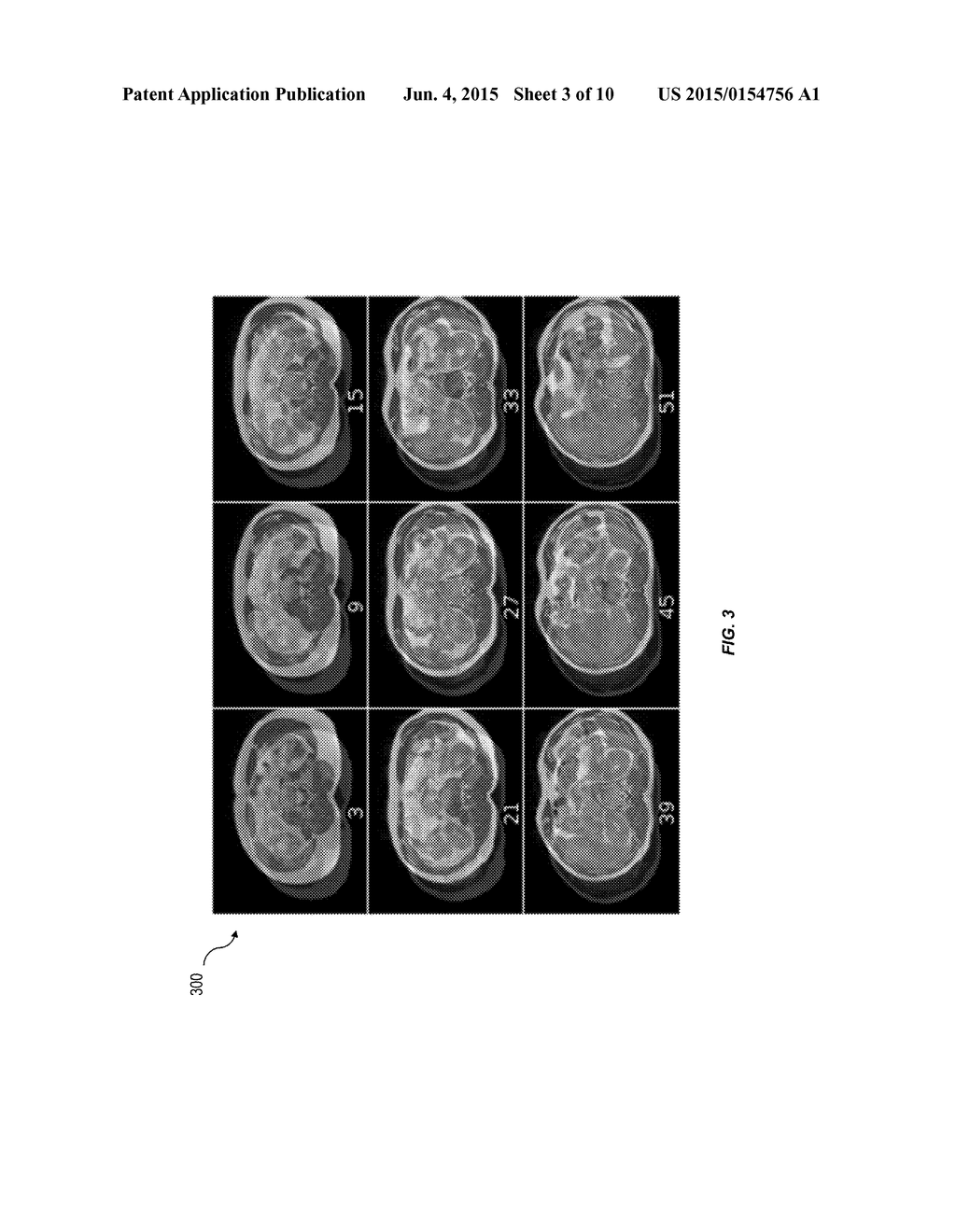 Single- And Multi-Modality Alignment Of Medical Images In The Presence Of     Non-Rigid Deformations Using Phase Correlation - diagram, schematic, and image 04