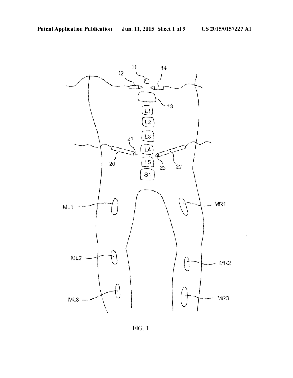 Electromyography System - diagram, schematic, and image 02