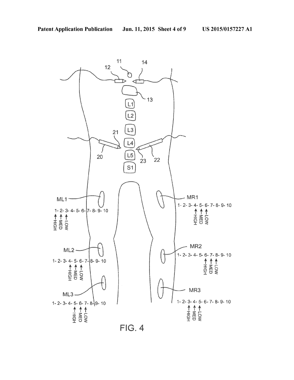 Electromyography System - diagram, schematic, and image 05