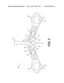 ELECTRODE ARRAY AND METHOD OF PLACEMENT diagram and image