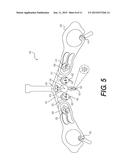 ELECTRODE ARRAY AND METHOD OF PLACEMENT diagram and image