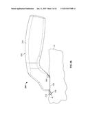 DEVICES AND METHODS FOR PERCUTANEOUS ENERGY DELIVERY diagram and image