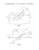 DEVICES AND METHODS FOR PERCUTANEOUS ENERGY DELIVERY diagram and image