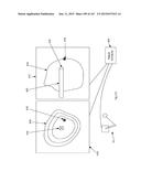 ROBOTIC CATHETER SYSTEM diagram and image