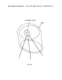 ROBOTIC CATHETER SYSTEM diagram and image