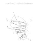 ROBOTIC CATHETER SYSTEM diagram and image