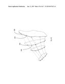 ROBOTIC CATHETER SYSTEM diagram and image