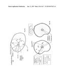 ROBOTIC CATHETER SYSTEM diagram and image