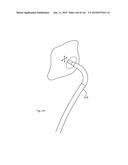 ROBOTIC CATHETER SYSTEM diagram and image