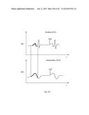 ROBOTIC CATHETER SYSTEM diagram and image