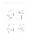 ROBOTIC CATHETER SYSTEM diagram and image