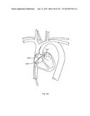 ROBOTIC CATHETER SYSTEM diagram and image