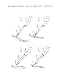 ROBOTIC CATHETER SYSTEM diagram and image